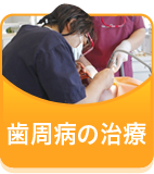 歯周病の治療